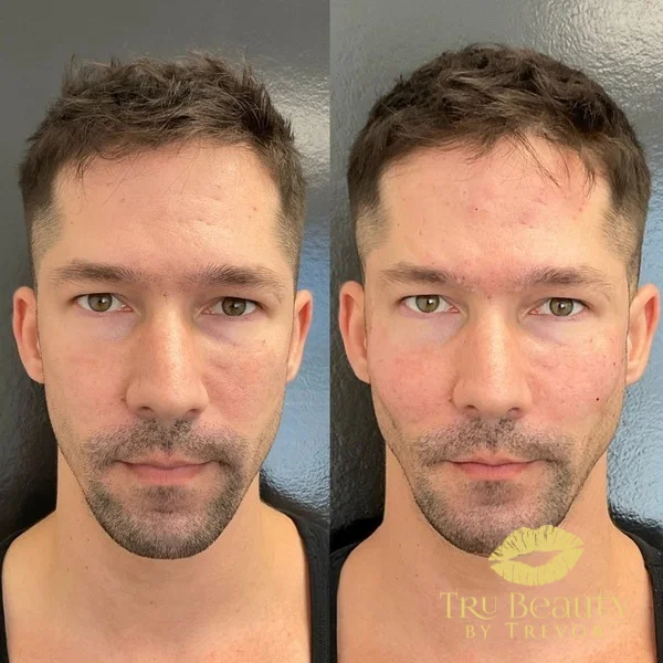 four-before-after