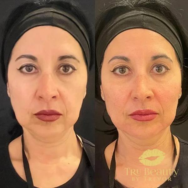 nine-before-after