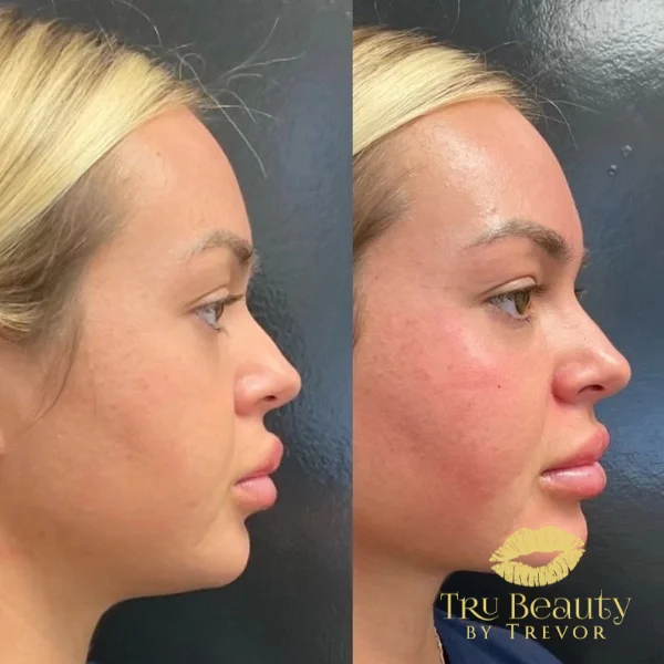 seven-before-after