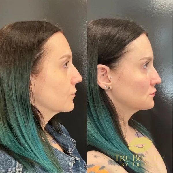 six-before-after