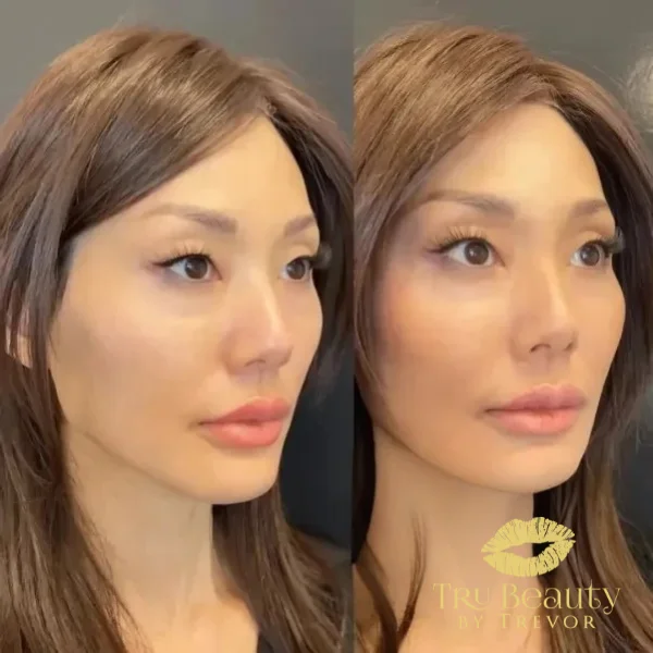 sixteen-before-after