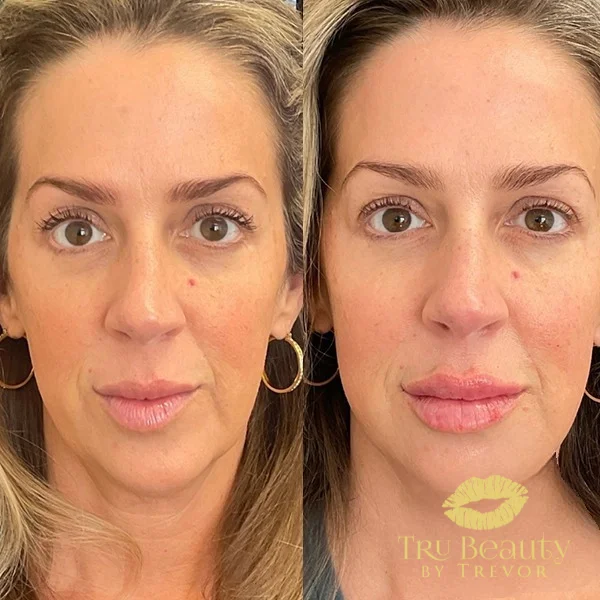 ten-before-after