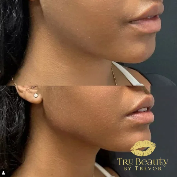 thirty-four-before-after