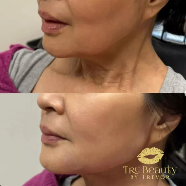 thirty-six-before-after