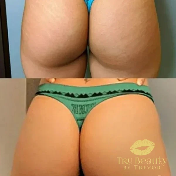 thirty-two-before-after