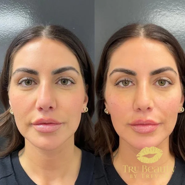 three-before-after