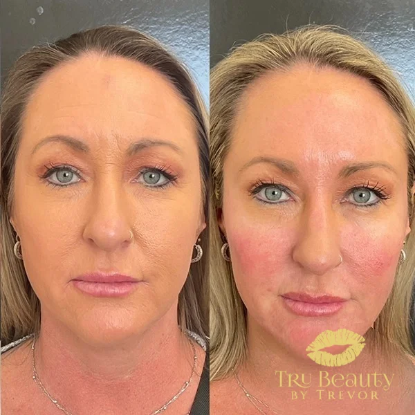 twelve-before-after