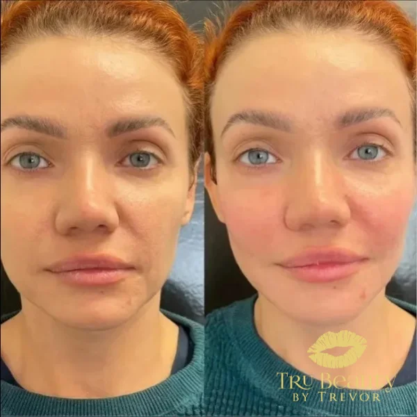 twenty-five-before-after