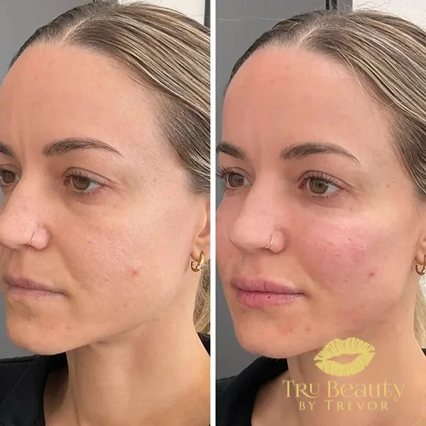 twenty-four-before-after