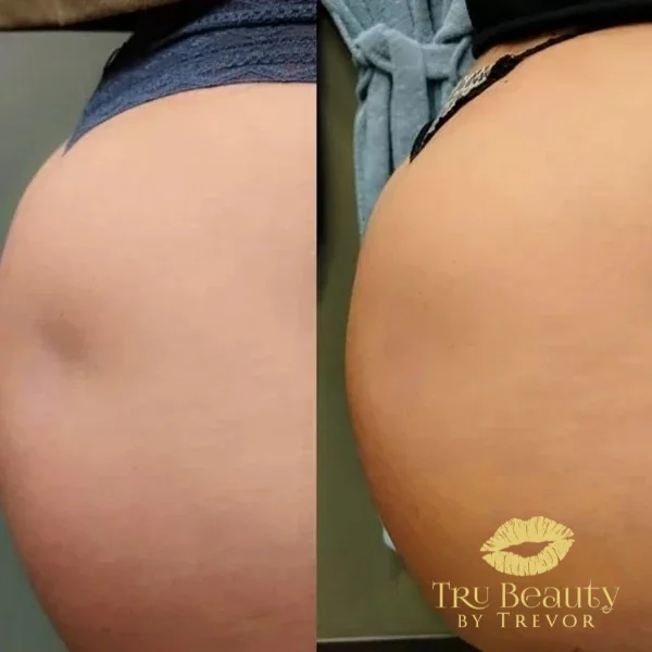 twenty-nine-before-after