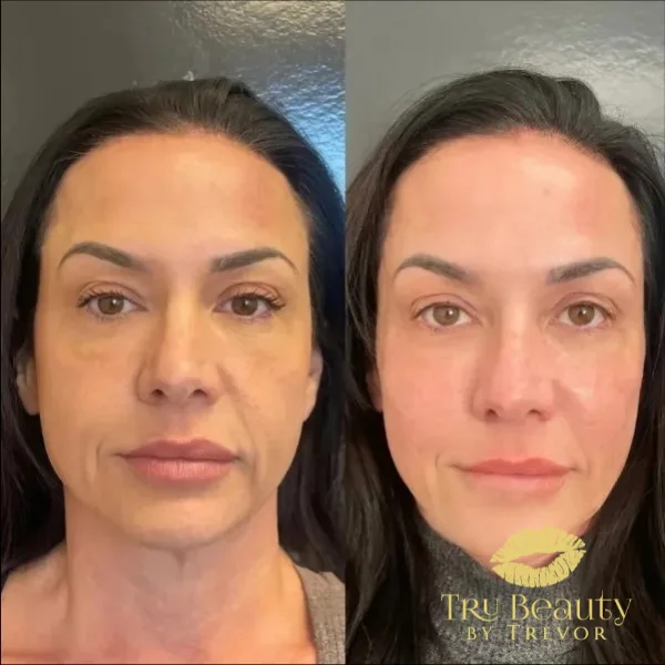 twenty-seven-before-after