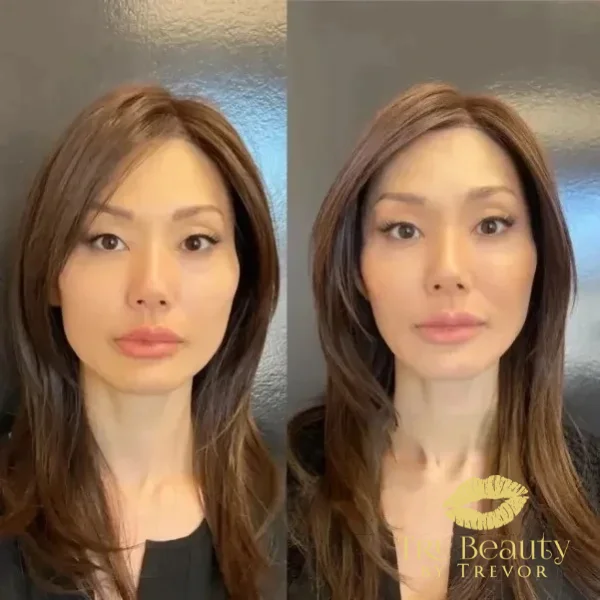 twenty-six-before-after