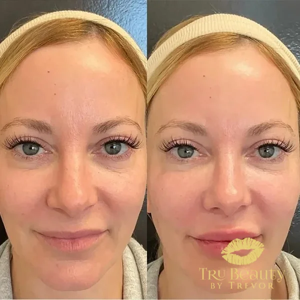 twenty-two-before-after
