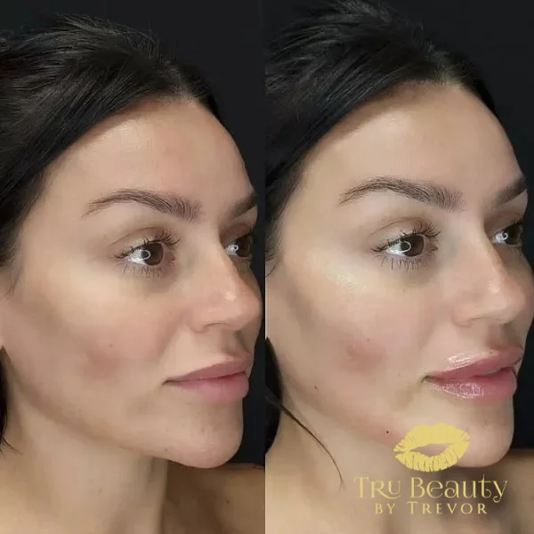 two-before-after