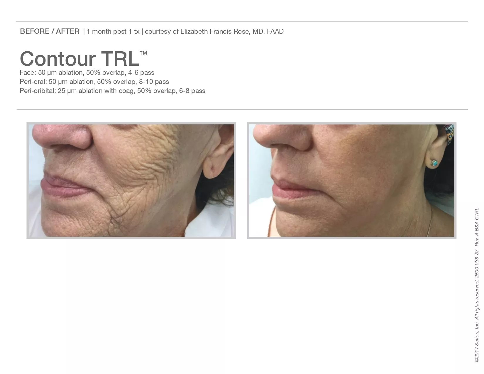 Trubeautybytrevor_Gallery_Image_CONTOUR_TRL_Before_and_After_Five_IN_HENDERSON_NV
