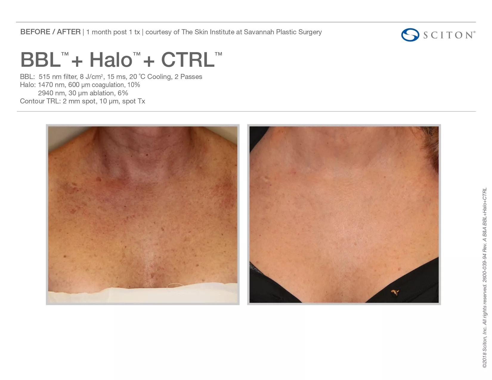 Trubeautybytrevor_Gallery_Image_Halo_Before_and_After_Five_IN_HENDERSON_NV