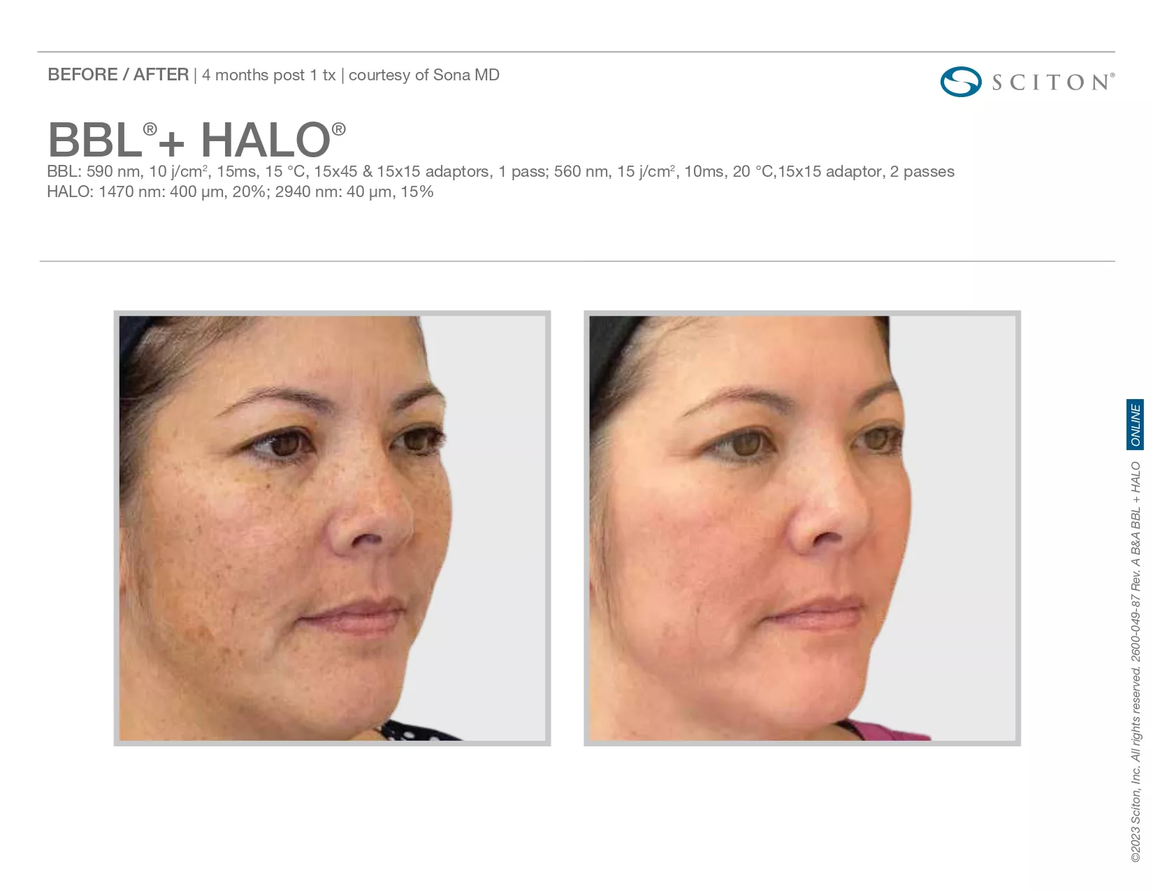 Trubeautybytrevor_Gallery_Image_Halo_Before_and_After_One_IN_HENDERSON_NV