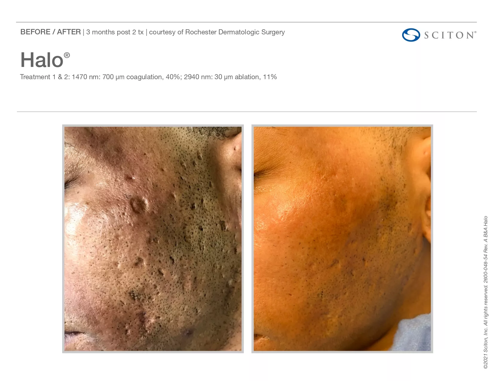 Trubeautybytrevor_Gallery_Image_Halo_Before_and_After_Three_IN_HENDERSON_NV