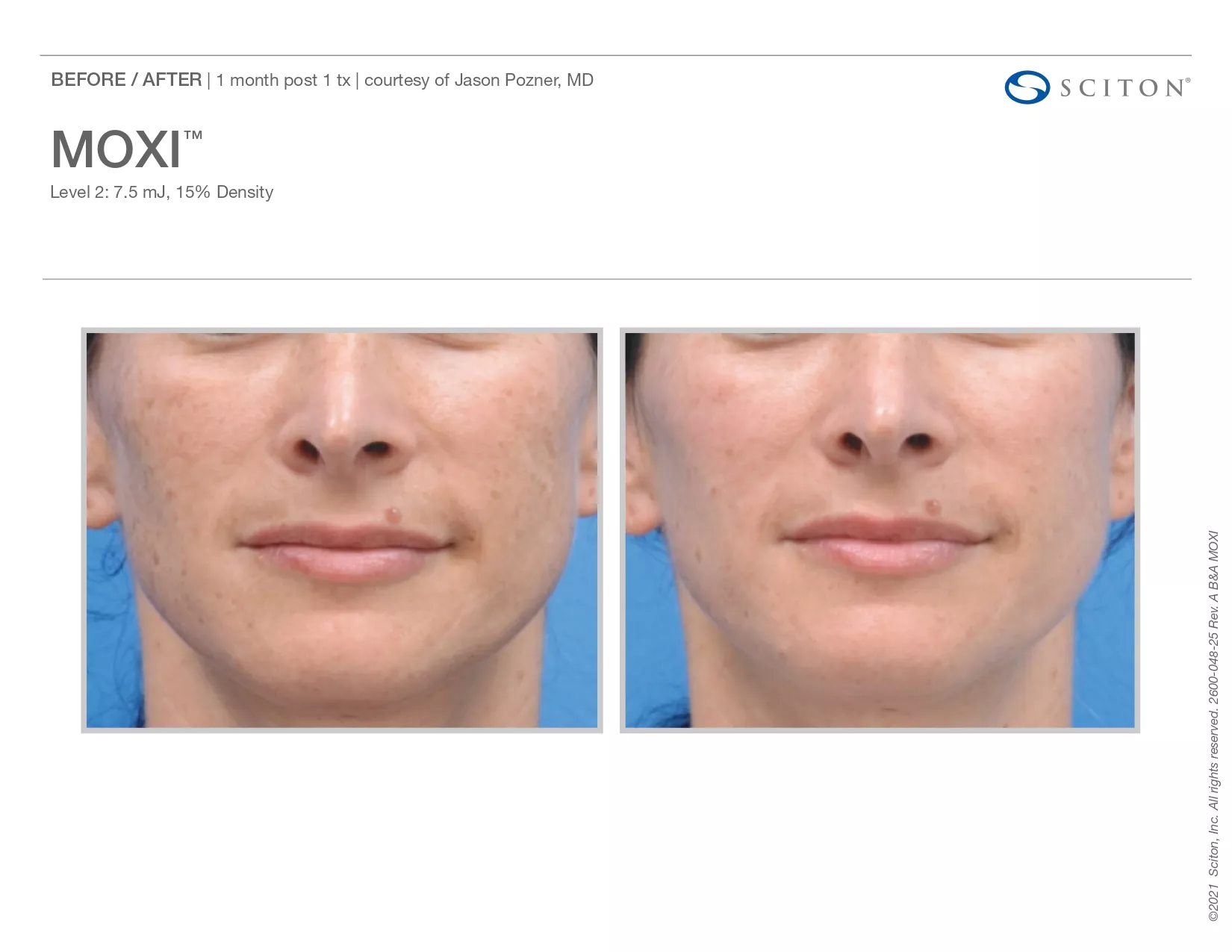 Trubeautybytrevor_Gallery_Image_Moxi_Before_and_After_Three_IN_HENDERSON_NV