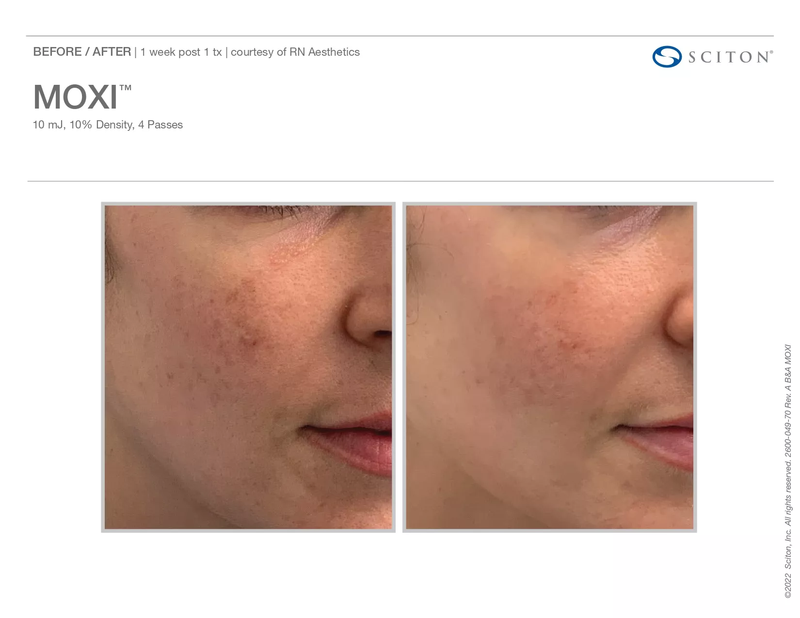 Trubeautybytrevor_Gallery_Image_Moxi_Before_and_After_One_IN_HENDERSON_NV
