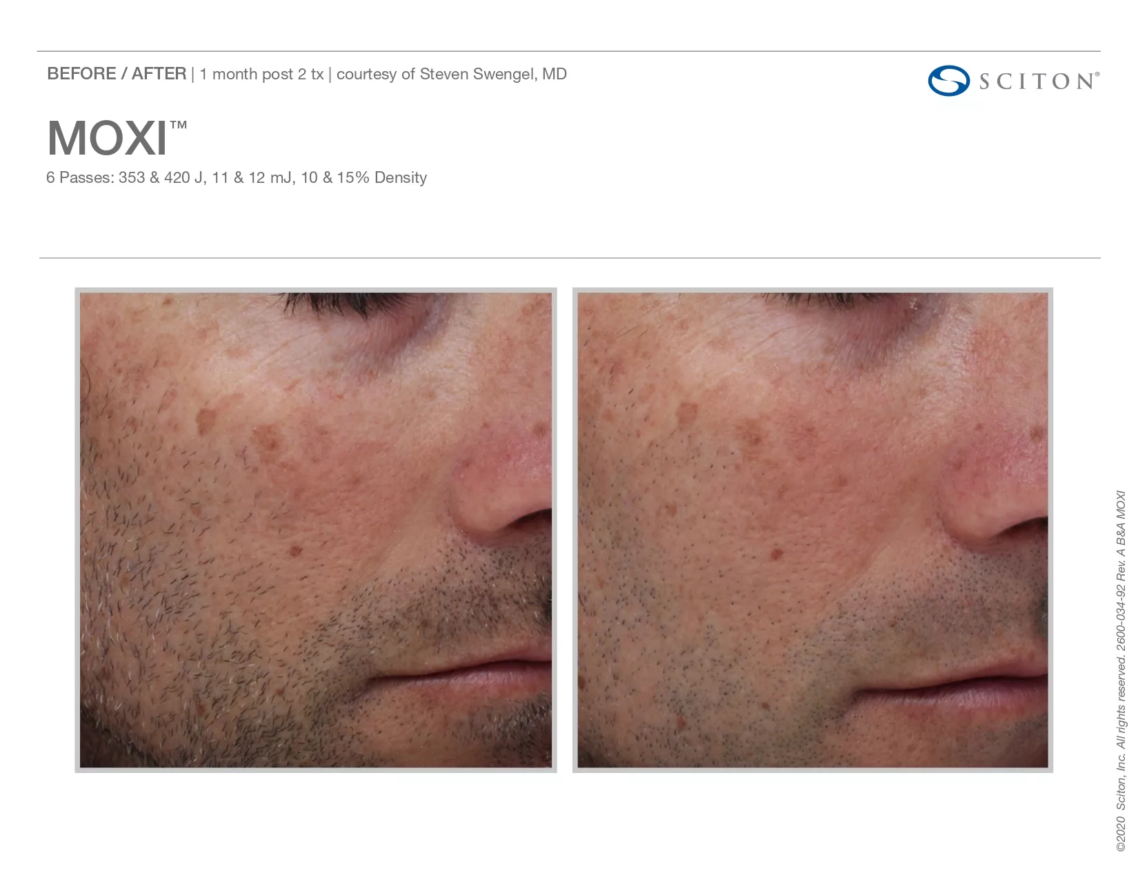 Trubeautybytrevor_Gallery_Image_Moxi_Before_and_After_Three_IN_HENDERSON_NV