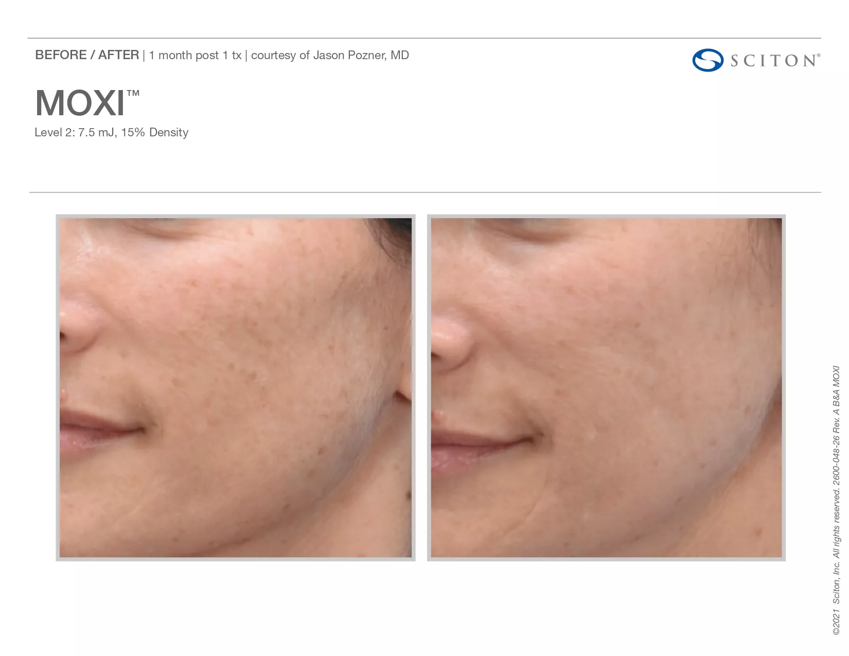 Trubeautybytrevor_Gallery_Image_Moxi_Before_and_After_Three_IN_HENDERSON_NV