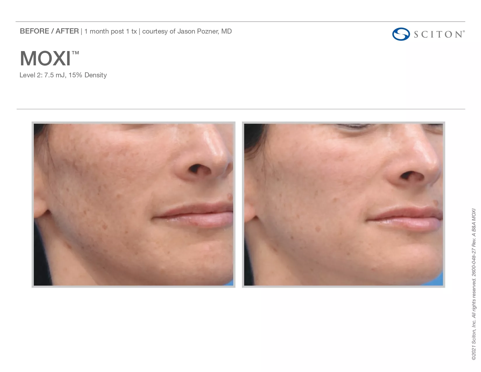 Trubeautybytrevor_Gallery_Image_Moxi_Before_and_After_Three_IN_HENDERSON_NV