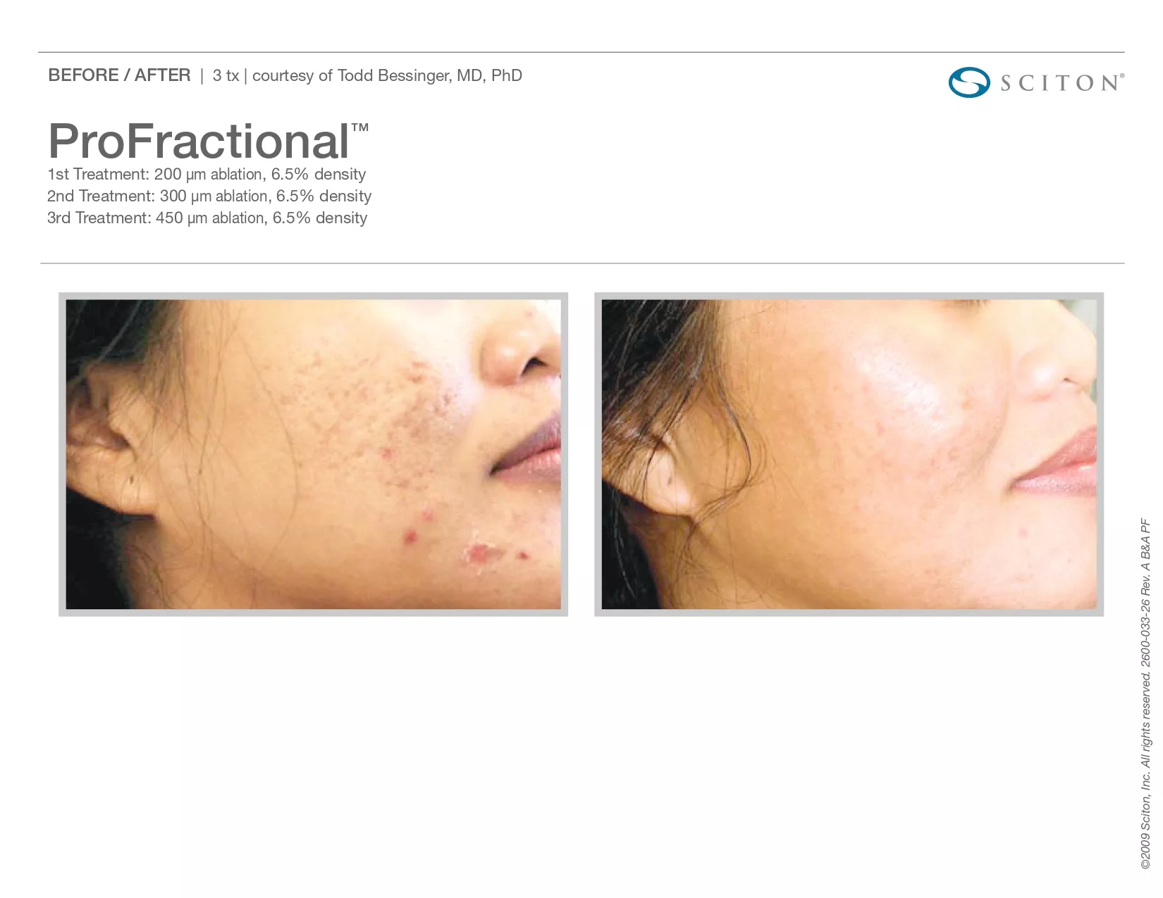 Trubeautybytrevor_Gallery_Image_PROFRACTIONAL_Before_and_After_Seven_IN_HENDERSON_NV