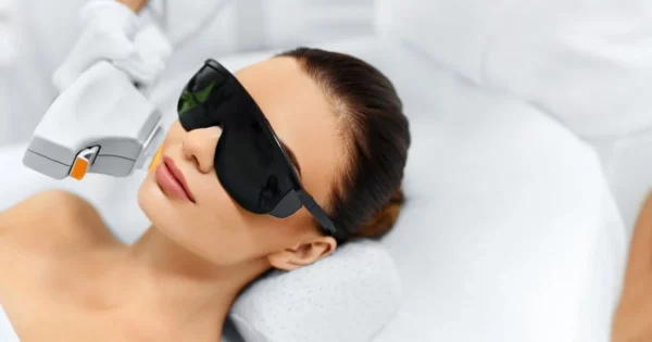 Morpheus8 for Stretch Marks: What You Need to Know